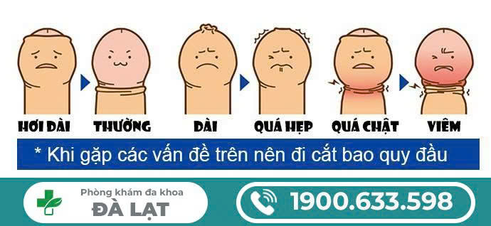 Hình ảnh minh họa